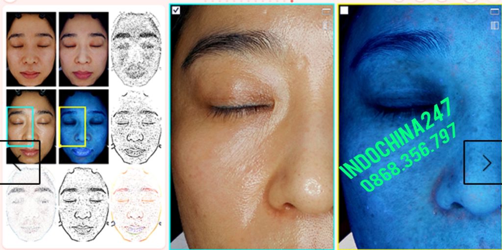 Nhận order và vận chuyển máy chụp da chuyên dùng Spa từ Hàn Quốc